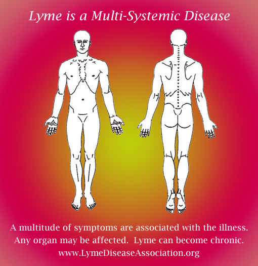 lyme multi systemic disease